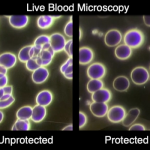 live blood before and after wearing an EMF necklace
