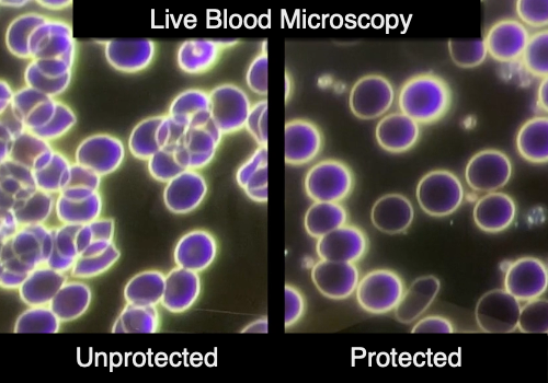 live blood before and after wearing an EMF necklace